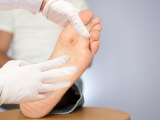 4 dấu hiệu bất thường ở chân nên “dừng lại” để kiểm tra sức khỏe